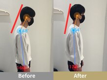 せなかのはね 難波心斎橋店/20代 猫背 ストネ 背中の張り