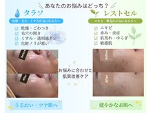 ラカ 川中島店(LaKa)の雰囲気（【フェイシャル】毛穴/ニキビ/くすみ/たるみ/肌質改善）