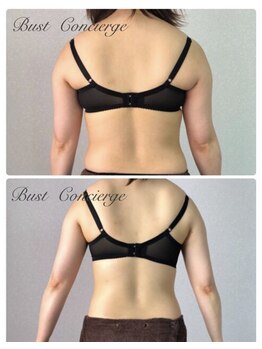 カナエルサロン 旭川(KANAERU SALON)/【バスト残しダイエット】症例☆