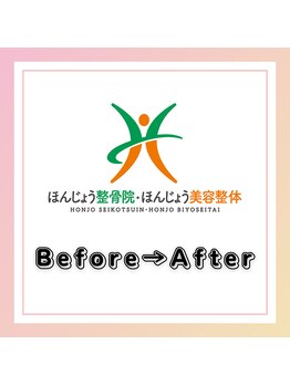 ほんじょう整骨院 美容整体/■Before→After