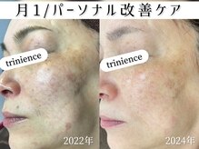 トリニエンス 新宿店(TRINIENCE)/60代/パーソナル改善ケア