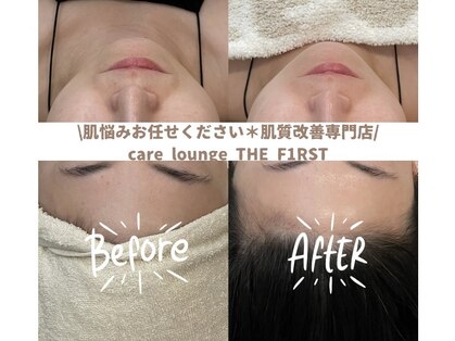 ケア ラウンジ ザ ファースト(THE F1RST)の写真