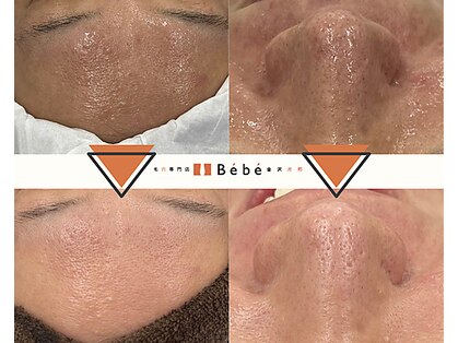 ベベ 金沢片町店(Be’be’)の写真