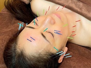きえ鍼灸整骨院の写真/【生野区・鶴橋】鍼灸初心者さんもプロにお任せください♪眼精疲労解消専用の美容鍼クーポンあり◎