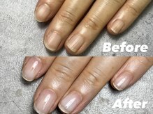 結(Yui)/自爪育成 Before→After