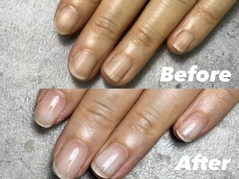 結(Yui)/自爪育成 Before→After