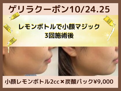 フェリス(feliz)の写真