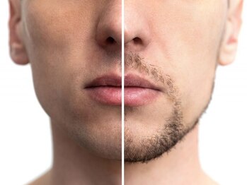 フォーケア(4Care)の写真/【エステ×脱毛×ネイル】仕事もプライベートも好印象！スッキリ美顔で好感度格上げ★ビジネス第一印象も◎