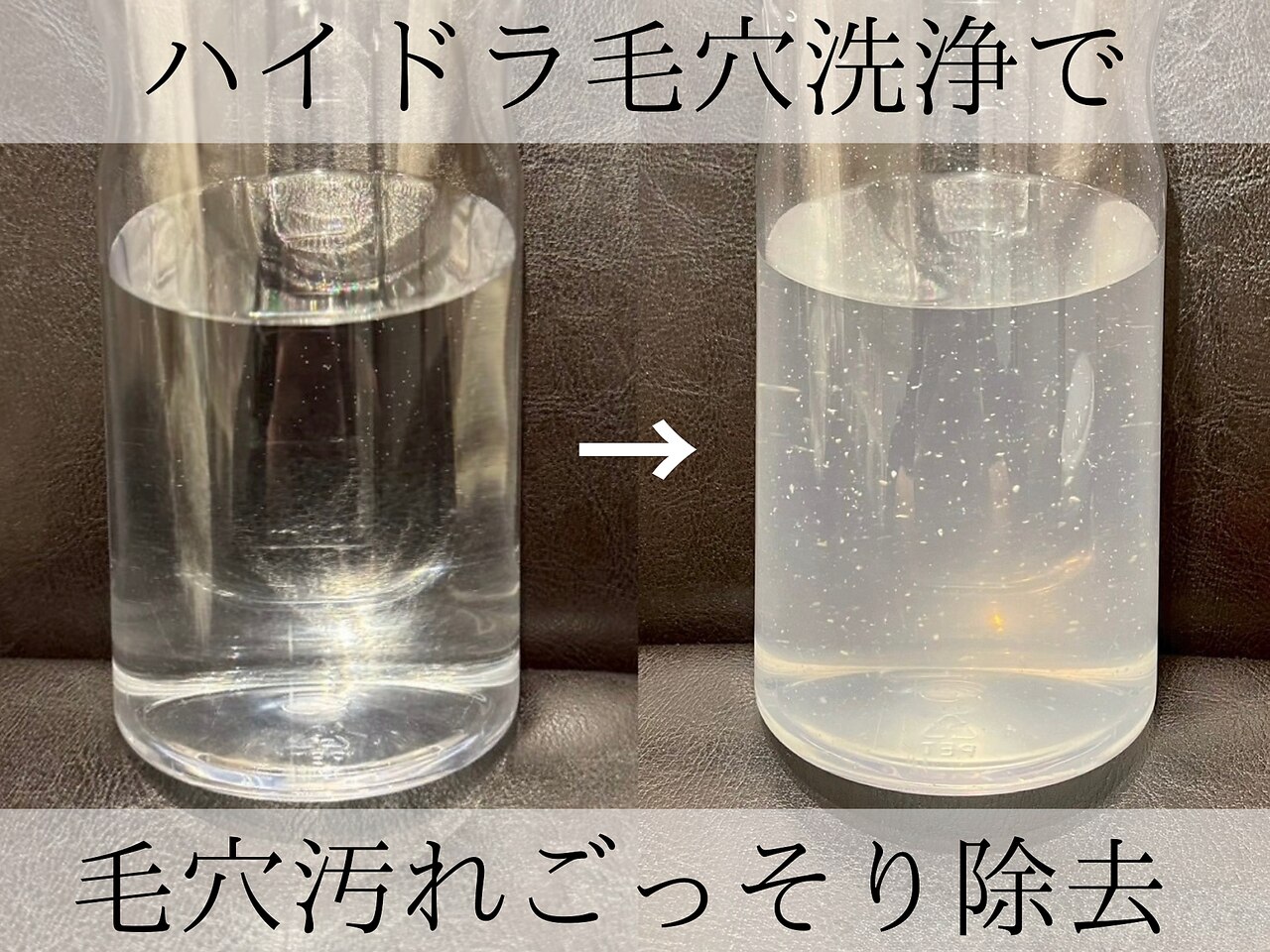 大阪市で毛穴洗浄・毛穴吸引が人気のエステサロン｜ホットペッパー