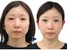 [小顔]も[リフトUP] も諦めたくない方★頭から引上げ【小顔矯正+頭蓋骨矯正】