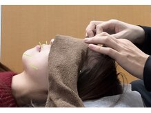 ながっち鍼灸治療院/美容鍼を受けたい！