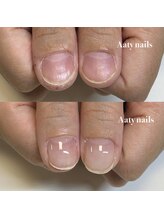 アーティネイルズ(Aaty Nails)/爪の形を綺麗に