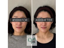 キュープ 富士店(Qpu)の雰囲気（1対1で、丁寧に小顔矯正をいたします。富士市/小顔矯正/たるみ）