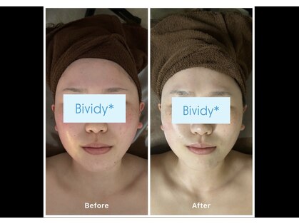 ビビディ(Bividy)の写真