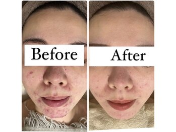 エルア 尼崎(Elua)/オーダーメイドメニュー