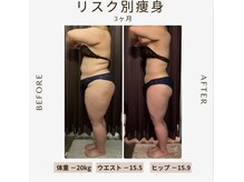 ビーシェイプ 君津(B-Shape)/【痩身】ビフォーアフター