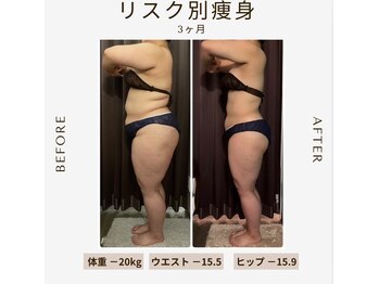 ビーシェイプ 君津(B-Shape)/【痩身】ビフォーアフター