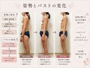 メデル(MEDEL)/姿勢もバストも変わる！
