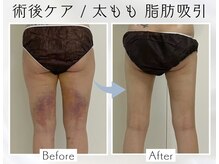 アピ(api)の雰囲気（術後ケアの得意なサロン。少ないインディバ回数でも効果を実感。）