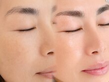 ケーアンド(K&)の雰囲気(大人気のフェイシャルWAXで眉もお肌も美肌にチェンジ!/逗子葉山)