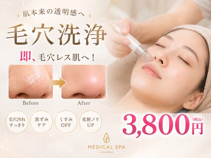 ルアナ(Luana)の写真