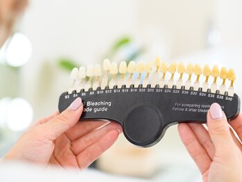 ホワイトニングビューティー 松戸店(Whitening Beauty)/歯のトーンチェック