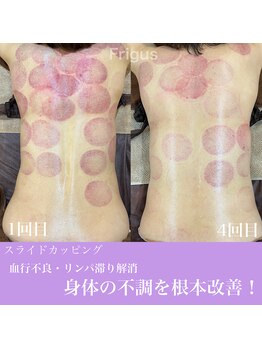 フリグス(Frigus)/【スライドカッピング】