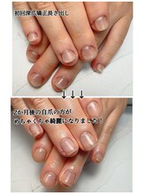 スマイルニコ(smile nico)/自爪風