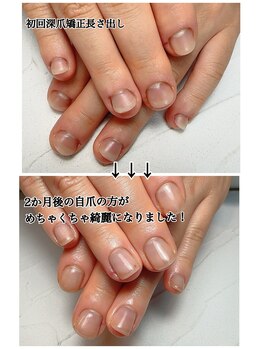 スマイルニコ(smile nico)/自爪風