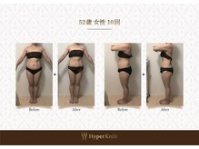 業界最上位マシンハイパーナイフEX正規取扱店】亀戸/整体/最強痩身/リンパマッサージ/ヘッドスパ