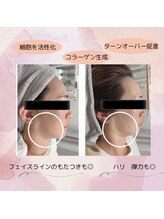 ラン(Ran)/変化写真♪