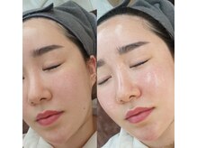 ケイビューティーセンター(K beauty center)の雰囲気（毛穴／毛穴洗浄/シミ改善／シワ改善／ニキビケア／美白）