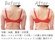シエル(Siele)/50代の方のバストアップ&痩身