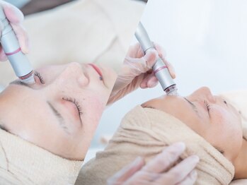 アーキ(ARCHI)の写真/【黒ずみ徹底ケア¥7,920】自信を持てるすっぴん肌に♪角質撃退オプションで奥の汚れまで徹底除去☆