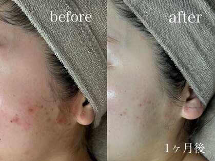 コム(comme39)の写真