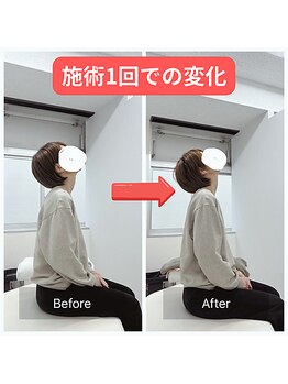 整体 寿 立川院(KOTOBUKI)/立川/整体/肩こり/腰痛/美容整体