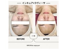ミロワール ドゥ サピュイェ(MIROIR de Sappuyer)/★根こそぎリフトアップ★