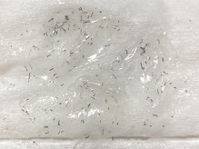 長崎駅前脱毛/その場で抜ける脱毛！