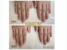 【HAND】深爪/ワシ爪　補正コース　クリアor自爪風仕上げ