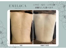 エミルカ(EMILUCA)