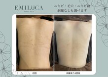 エミルカ(EMILUCA)