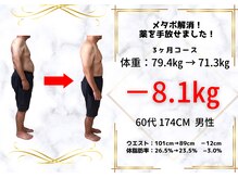 ヴレ 福岡店(Vraie)/下腹スッキリ変化