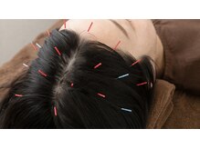 リリアン(Riliane)の雰囲気(頭はツボの宝庫◎)