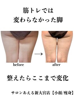 サロンあえる 新大宮店/筋トレでは変わらなかった脚