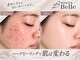 ベル 大宮(Belle)の写真