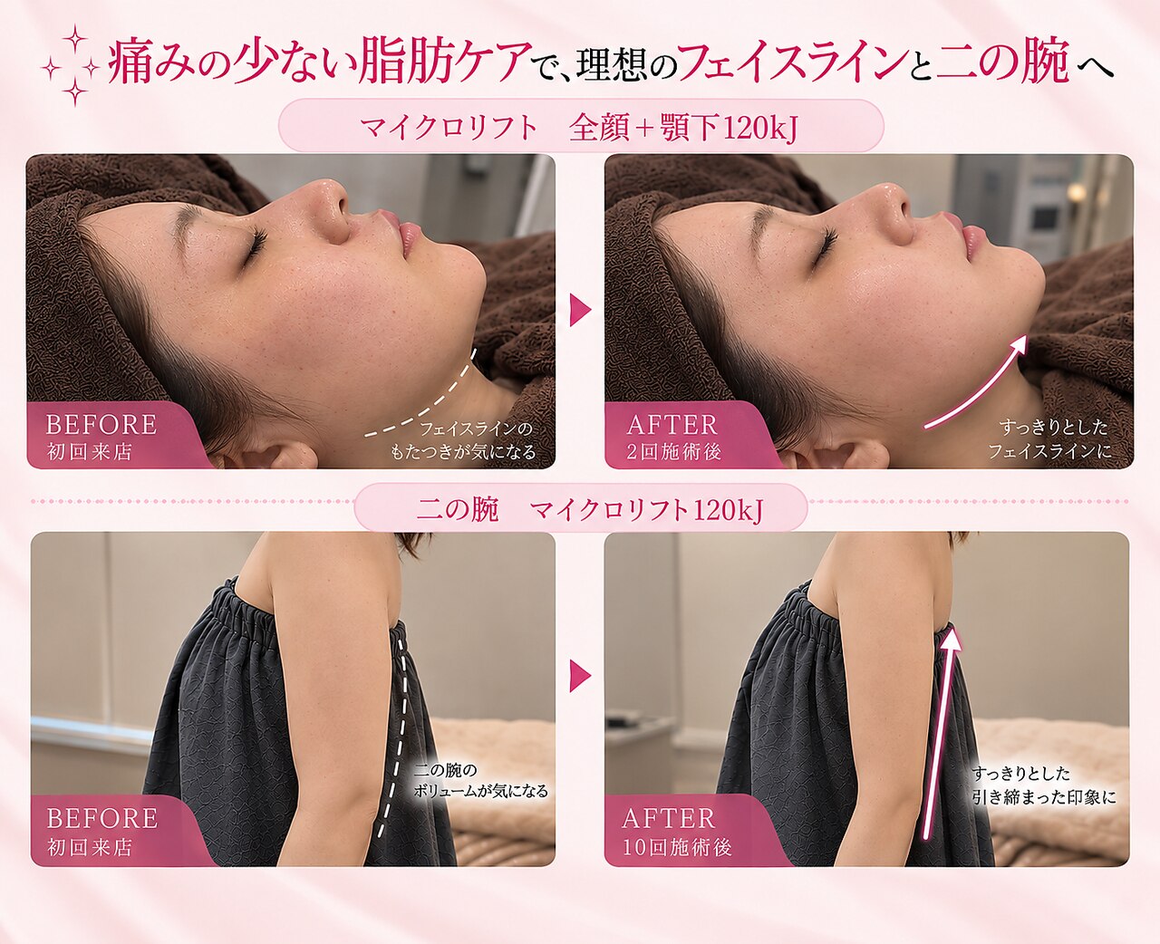 リフト 静岡(Lift)｜ホットペッパービューティー
