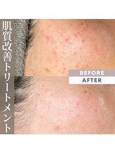 マール(MARL.)/クリスティーナトリートメント