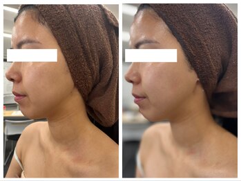 ルルボーテ(Loulou Beaute)/VOS/グレーズソフトピール