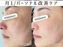 トリニエンス 新宿店(TRINIENCE)/40代/パーソナル改善ケア