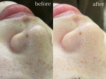 テオリア(TEORIA)/1回でもツヤ肌実感できます♪